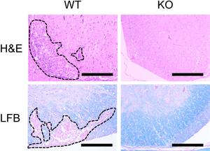 Role of STAP-1 in autoimmune disorders