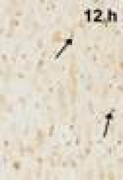 Cyclooxygenase-2-positive Cells