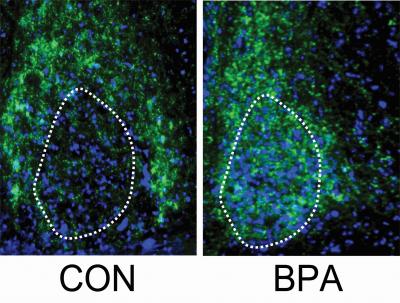 BPA Exposure below Regulatory Levels Effect on Developing Brain
