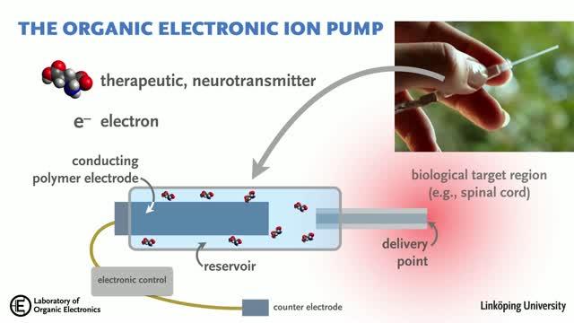 Implantable Bioelectronic Device Manages Nerve Pain (1 of 2)