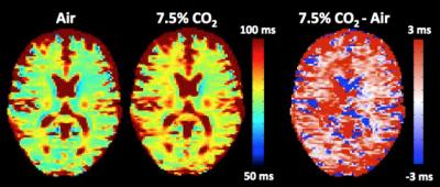 MRI Detects pH Changes
