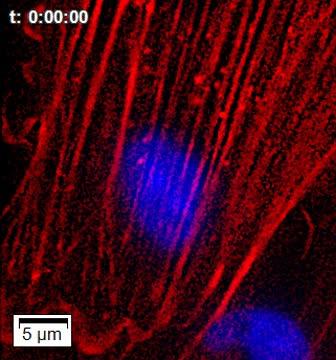 Blood Cell Wall Bending as Leukocyte Passes Through