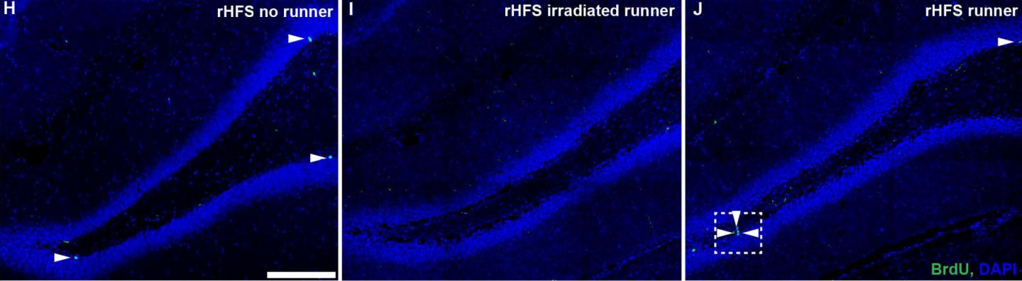 New Neurons, Old Memories