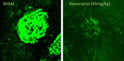Mouse Retina With and Without Resveratrol