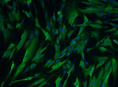 RNA-transfected Fibroblasts