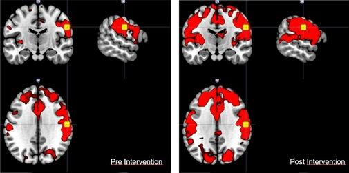 Virtual Reality Applied To Rehabilitation For Eurekalert