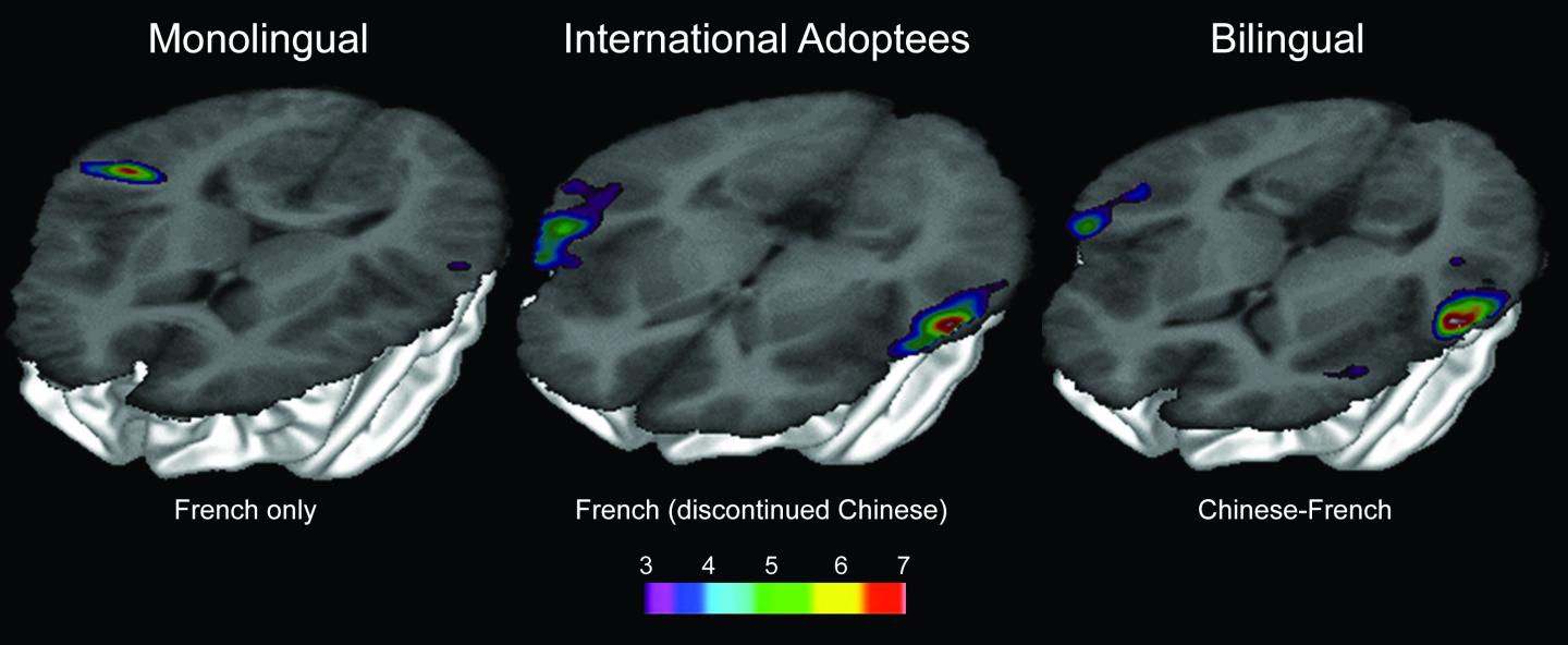 Brain Activation Patterns for Processing Chinese Tones
