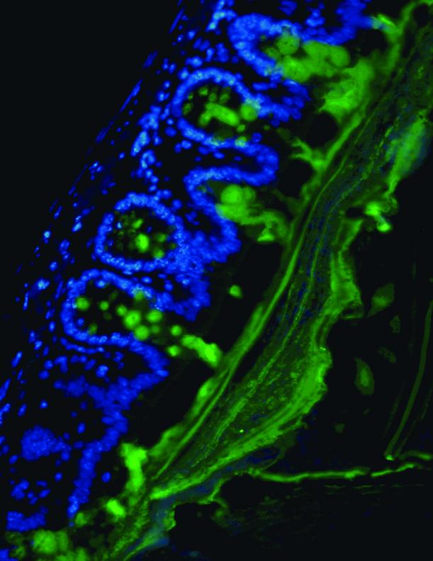 Colon-Protecting Mucus Layer