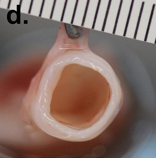 Biological Blood Vessel Grafts with No Living Parts Perform Well in Primates (6 of 7)