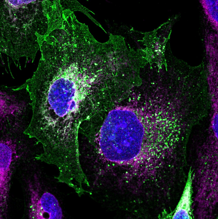 Image of patient derived podocyte kidney cells repaired with novel baculovirus-vectored approach pioneered by the Berger team.