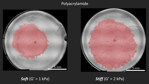 Serratia marcescens biofilms