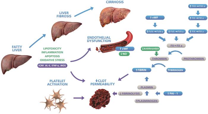 Possible alterations in the coagulation cascade, fibrinolysis, platelet and ED associated with non-alcoholic fatty liver disease, with mechanisms responsible for potential prothrombotic and procoagulant imbalance in patients with NAFLD.