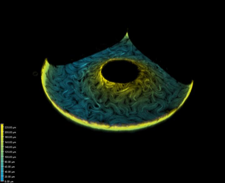 Toroid Covered with Microtubules