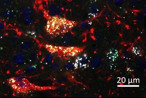 This confocal microscope image shows midbrain neurons (red) co-expressing the mu-opioid receptor (Oprm1, white) and cannabinoid receptor 1 (Cnr1, green).