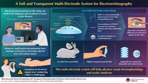 A soft multi-electrode electroretinography system for diagnosing and studying ocular diseases