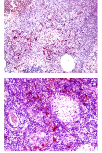 Tumors Use Enzyme to Recruit Regulatory T cells and Suppress Immune Response 1 (of 2)
