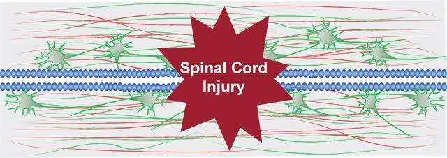 Spinal Cord Injury and Regeneration in Zebrafish