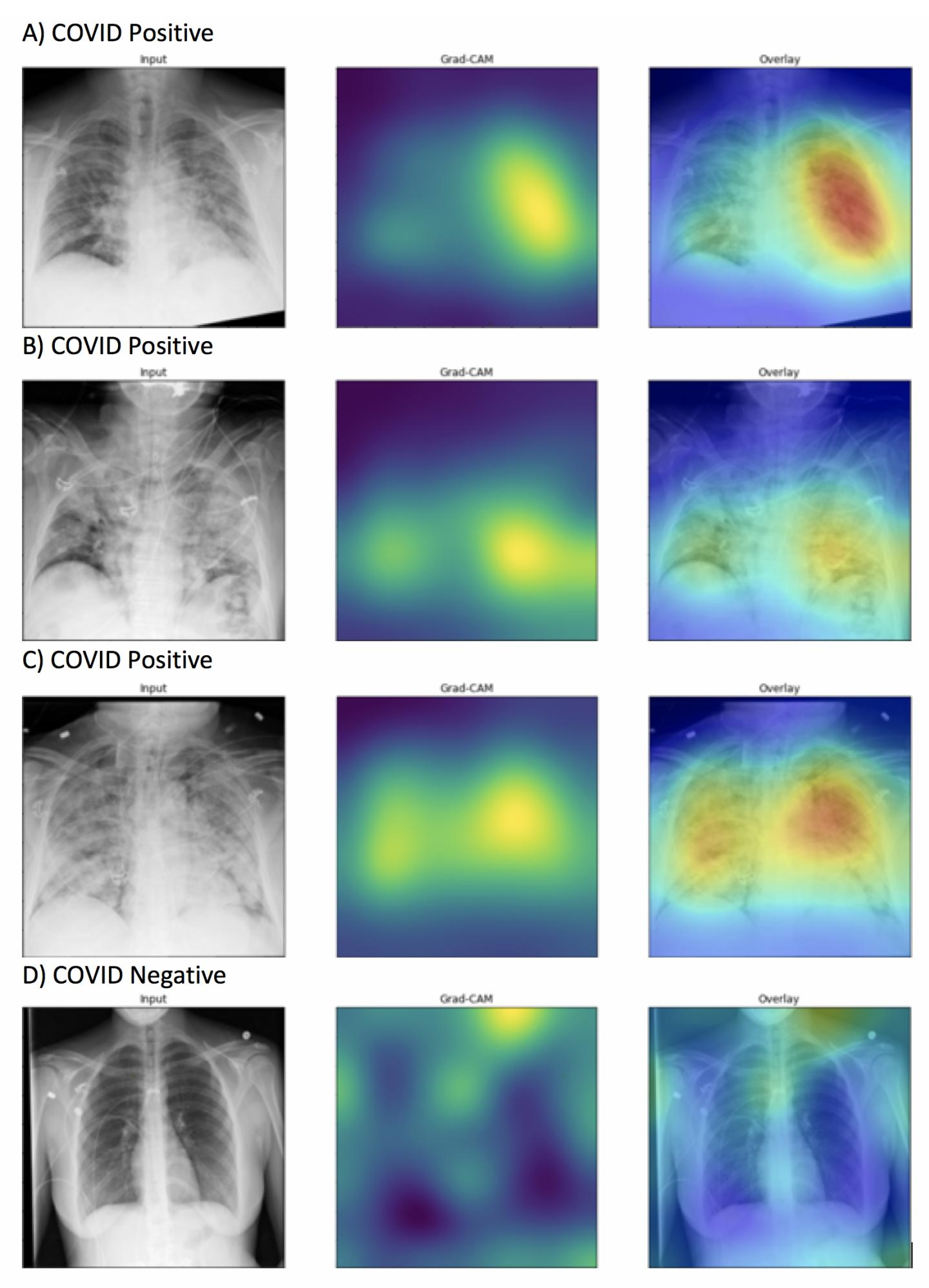 Grad-CAM heat maps of feature importance for positive COVID-19 prediction