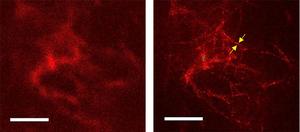 The interwoven fibril-like structure of amyloid-beta plaques in mouse brain tissue visualized using super-resolution STED microscopy