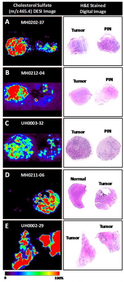 Images of Analysis of Prostate Tissue Samples