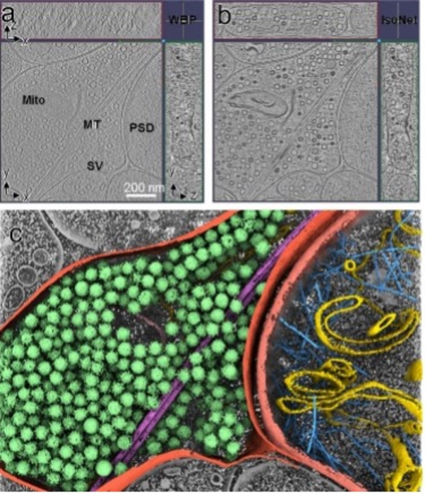 Isotropic reconstruction for electron tomography with deep learning