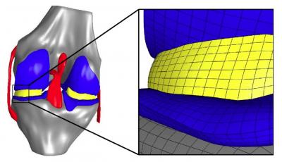 Compressive Loading: Finite Element Model