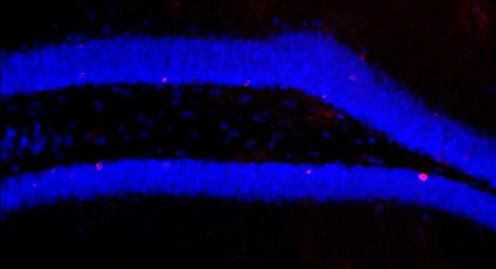 Microscopic Image of the Hippocampus of Treated Mice