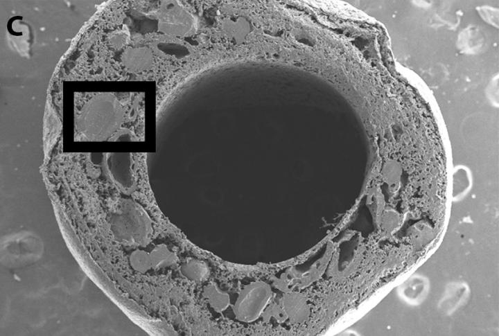 Synthetic Nerve Conduit Bridges the Gap in Arm Nerve Repair (2 of 10)