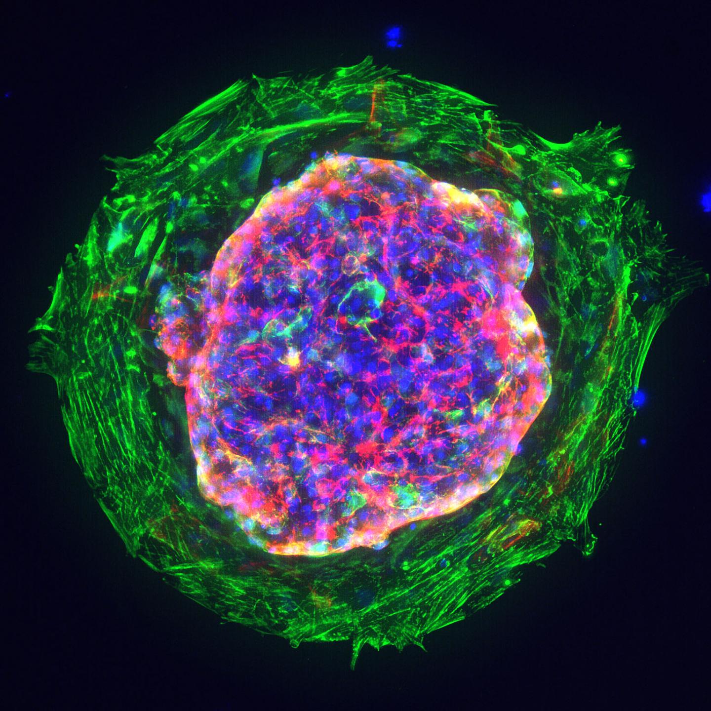 Human Cardiac Organoid