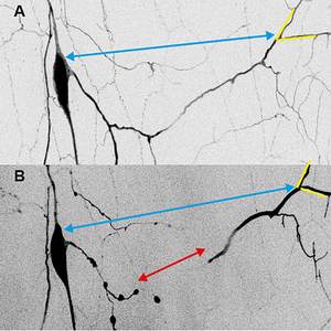 Forces acting on dendrites