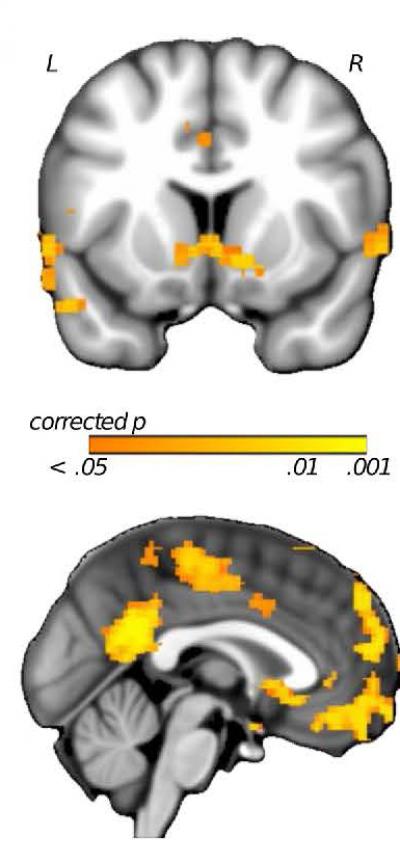 Neural Regions Modulated by Setback Controllability