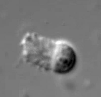 <I>C. elegans</I> Sperm (1 of 2)