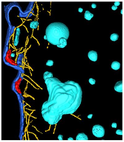 Red Blood Cells with Mutated Hemoglobin Variants