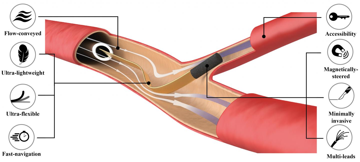 Schematic representation