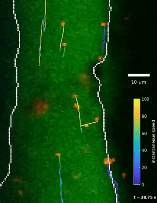 AI helps show how the brain's fluids flow - EurekAlert