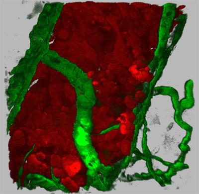 VEGF Secreting Human Tumor Cells