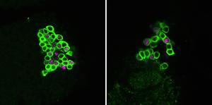 Parkinson’s: are our neurons more vulnerable at night?