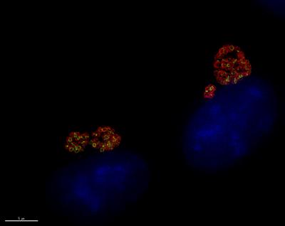 <i>Chlamydia</i> Peptidoglycan is Revealed by a New Bacterial Labeling Method