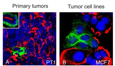 Luminal-Like and Basal-Like Breast Cancer Cells