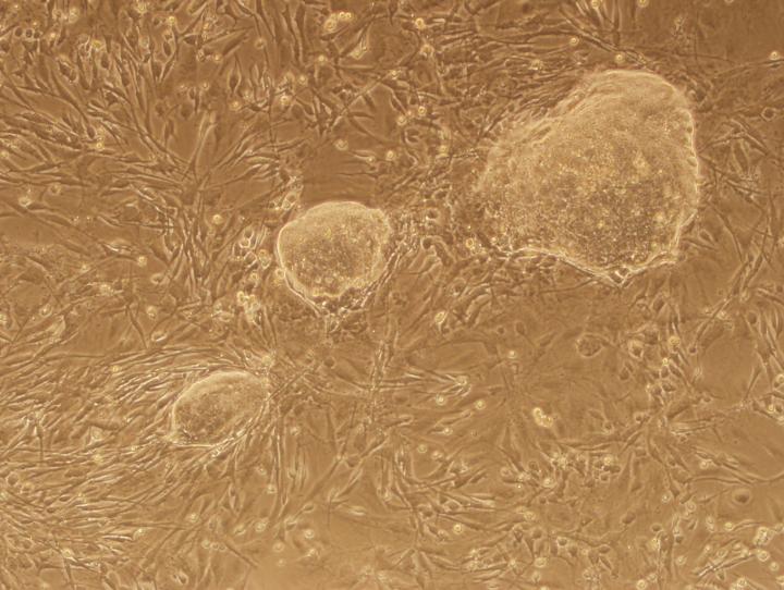 iPS Cell Colonies Generated After Cell 