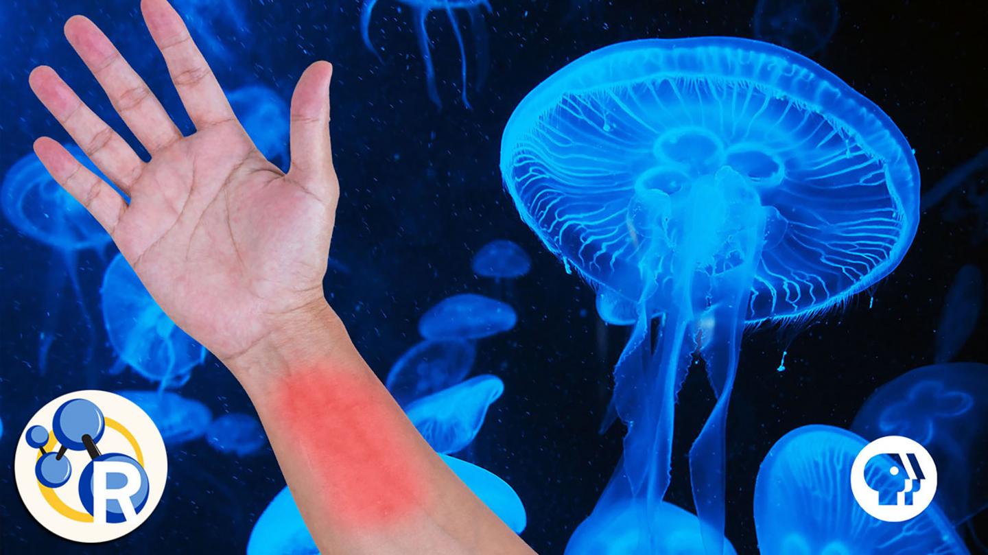 Jellyfish Sting