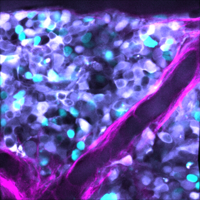 3. Neuroblastoma chemoresistance Max Nobis / Garvan