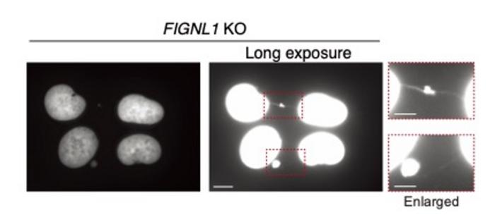 Cells lacking FIGNL1, a specialized enzyme, manifest abnormal chromosome bridges between pairs of chromosomes during cell division