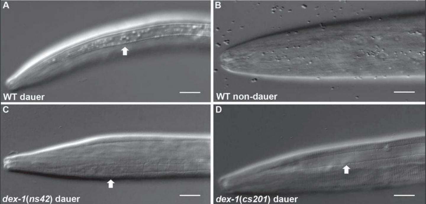 <i>C. elegans</i> Showing Dauer Phase