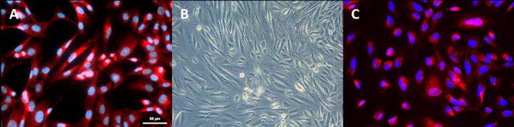 Amniotic Fluid Derived Stem Cells Express Kidney Markers