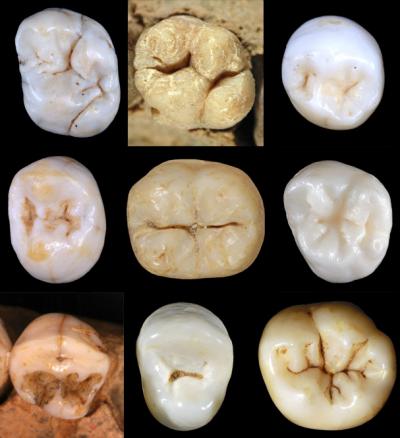 Molars and Premolars