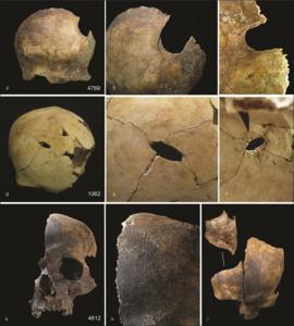 Cranial trauma - evidence.