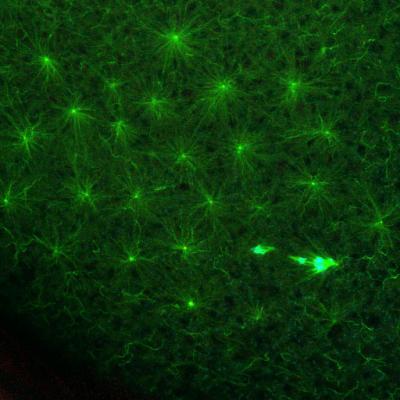 Oocyte with Centrioles Artificially Retained