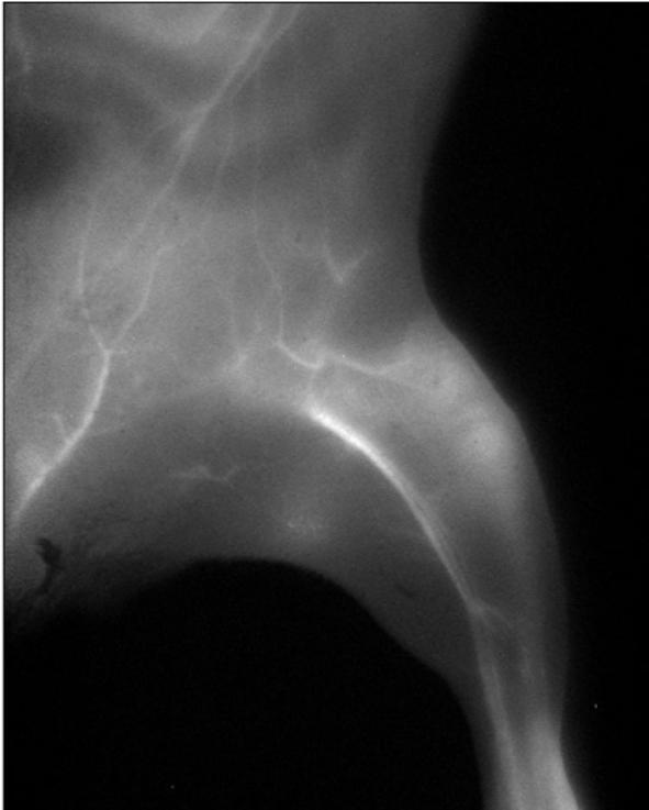 A mouse hindlimb image recorded in NIR-IIa