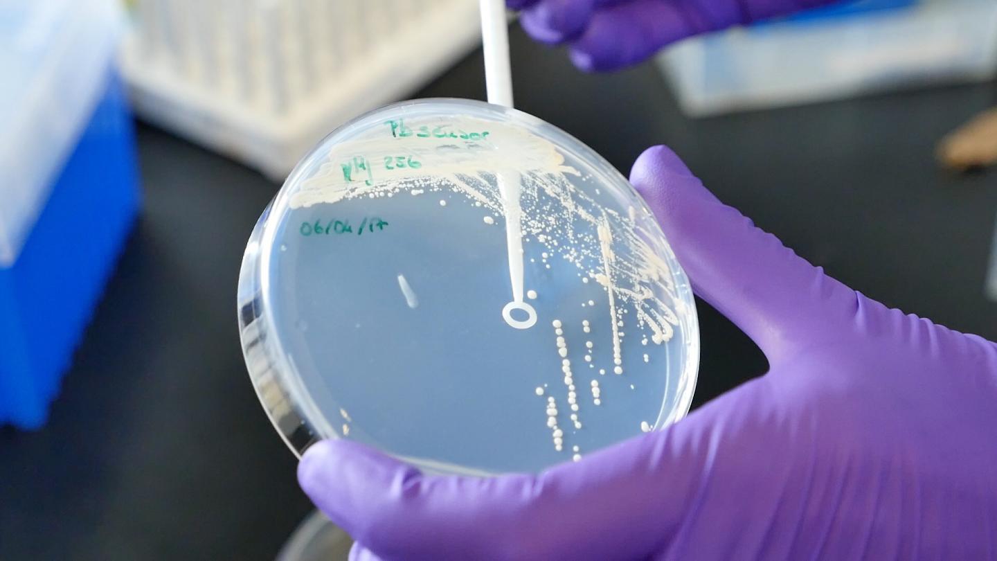 Modifying Baker's Yeast for Low-cost Detection of Fungal Pathogens (1 of 12)